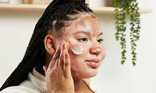 Ameliorate Treatments